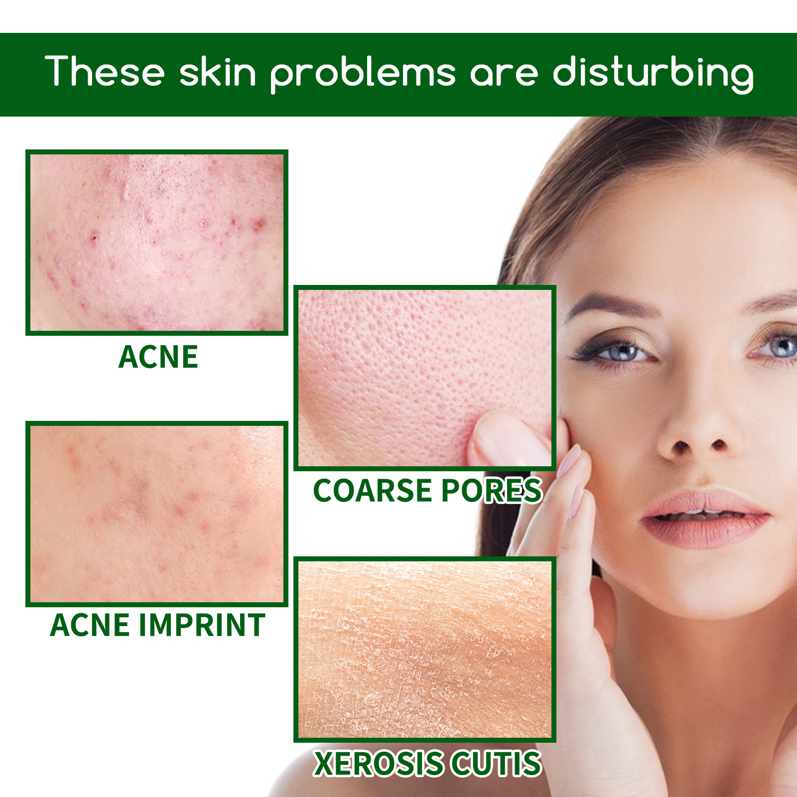 Salicylic Acid Anti Acn-e Face – обзор и цена Glycolic Acid Exfoliant