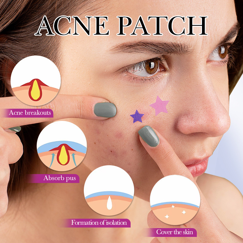 7/10/14Pcs Colorful Star Acne  – обзор и цена Skincare Qv