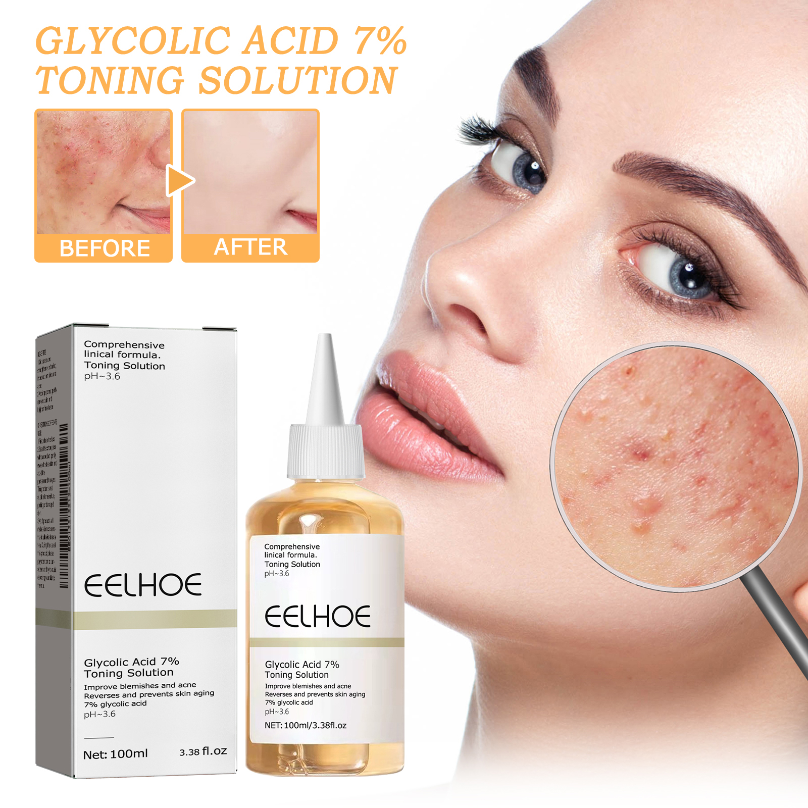 100ml Glycolic Acid Toning Sol – обзор и цена Lactic Acid Toner