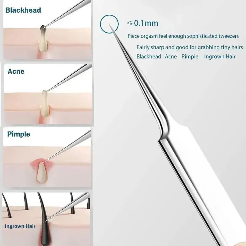 11Pcs/Set Acne Needle Blackhea – обзор и цена Skincare Qv