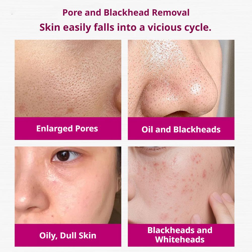 Salicylic Acid Shrink Pores Se – обзор и цена Glycolic Acid Exfoliant
