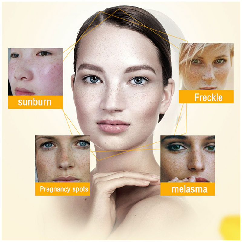 Dimollaure Whitening Freckle C – обзор и цена Skincare Korea