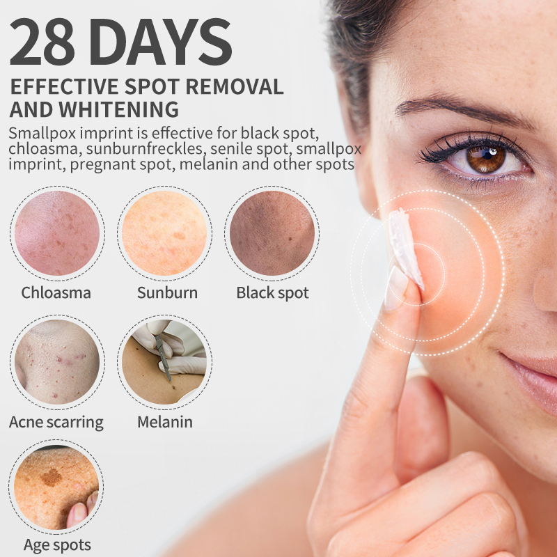 Dimollaure Whitening Freckle C – обзор и цена Skincare Korea