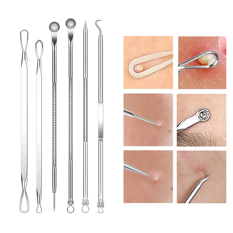 4-11Pcs Ingrown Hair Tweezers  – обзор и цена Skincare Qv