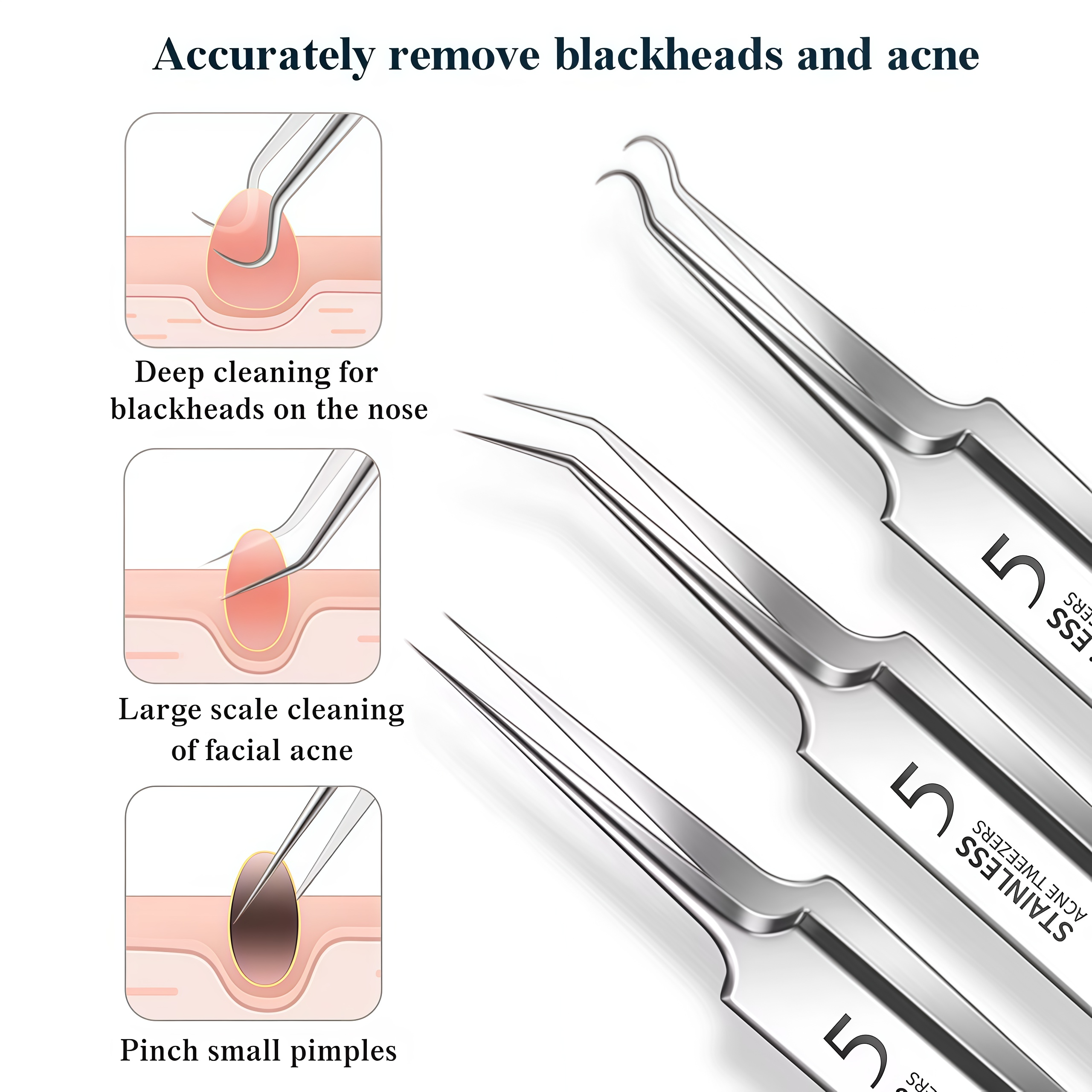 4-11Pcs Ingrown Hair Tweezers  – обзор и цена Skincare Qv