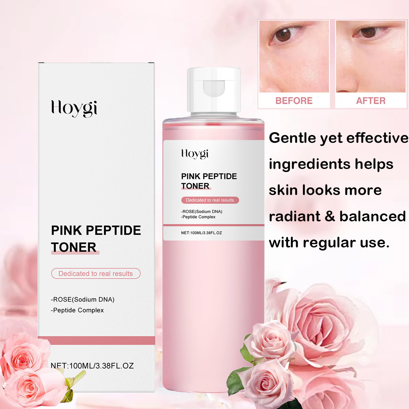 Rose Essence Toner Glowing Ski – обзор и цена Lactic Acid Toner