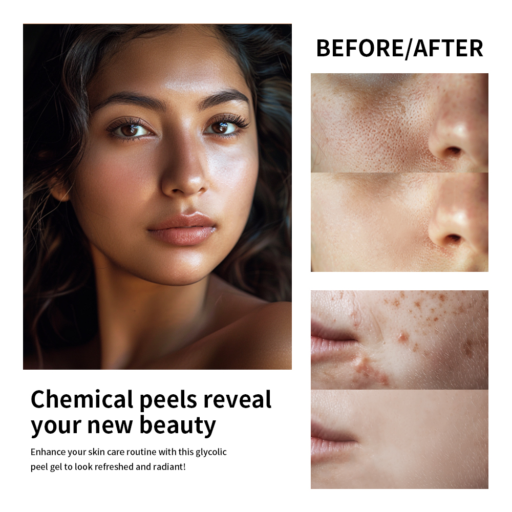 30% Glycolic Acid Face Care Lo – обзор и цена Lactic Acid Toner