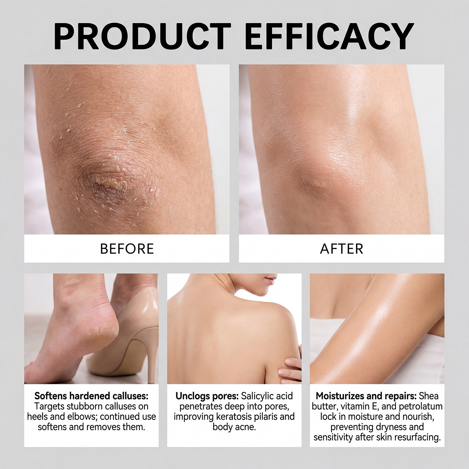 Exfoliating Body Stick Smoothi – обзор и цена Glycolic Acid Exfoliant