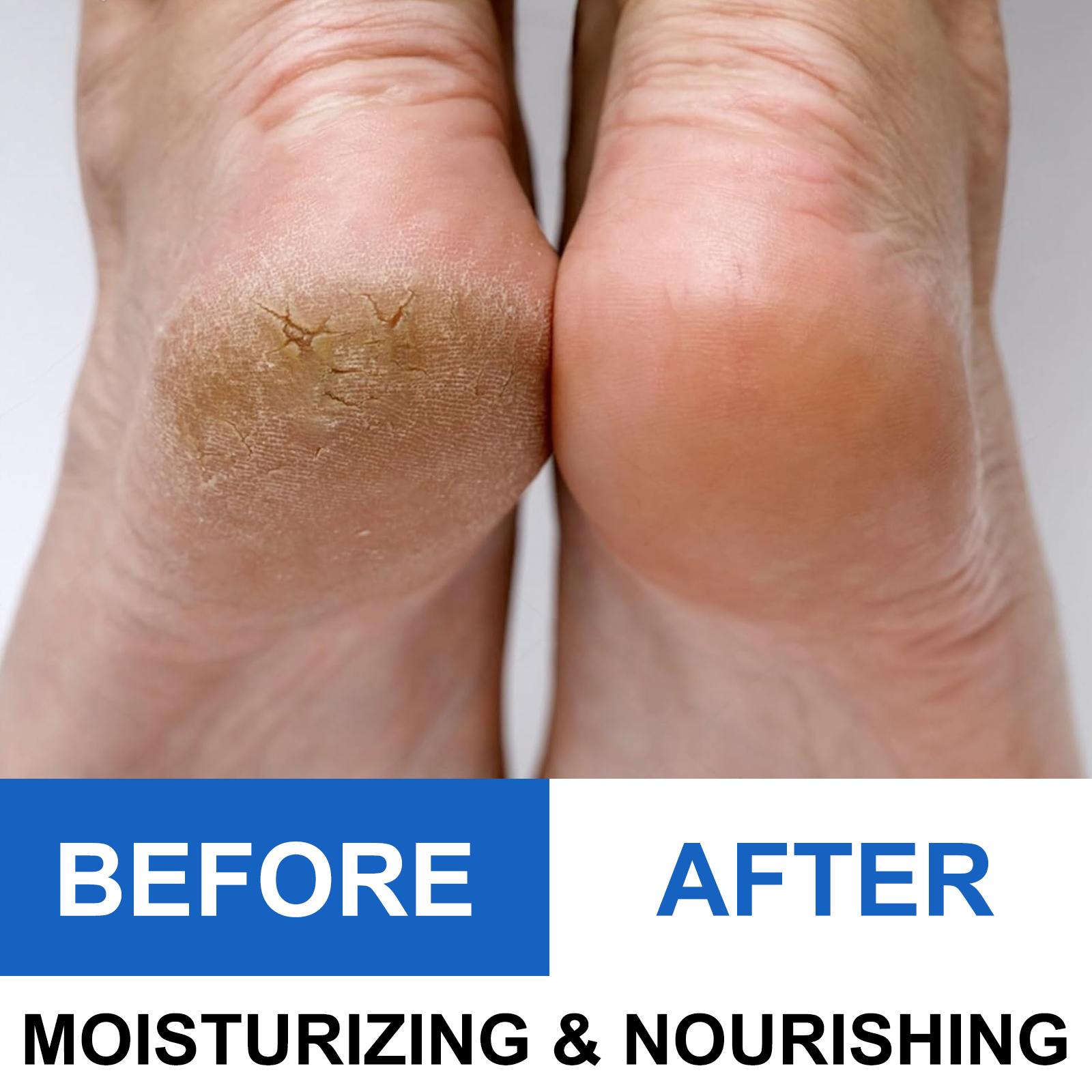 40% Urea Foot Cream Stick - Mo – обзор и цена Glycolic Acid Exfoliant