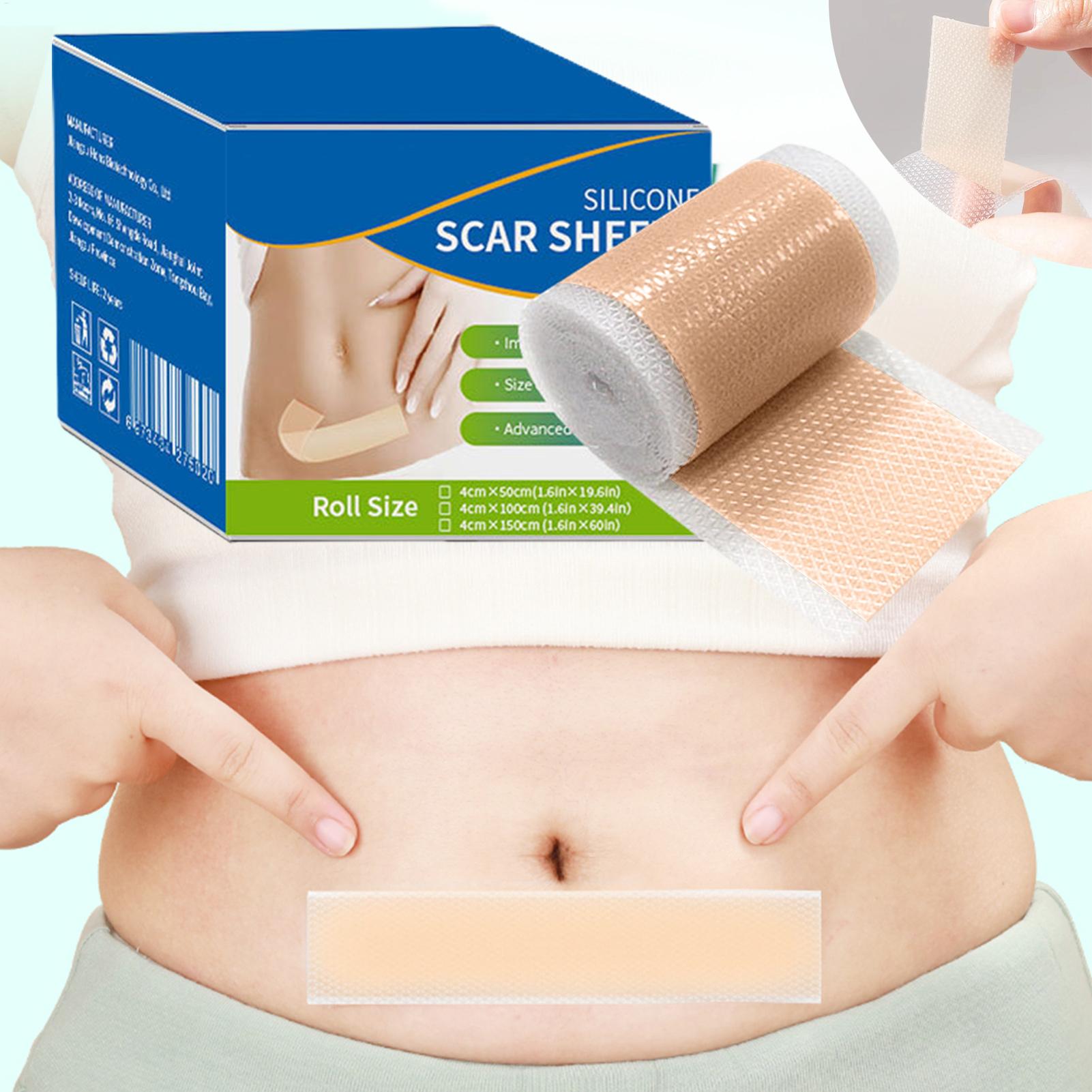 1 Roll Silicone Scar Sheets 4c – обзор и цена Skincare Collagen